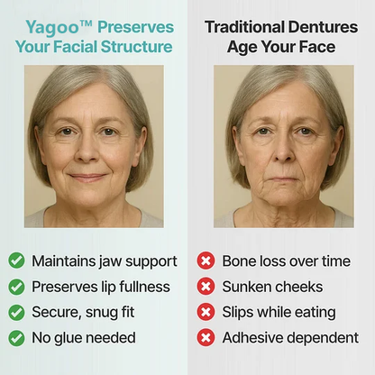 🏆YAGOO™ Custom Custom-Fit Full Functional DenturesMake you more confident – Made in the USA & FDA-Certified