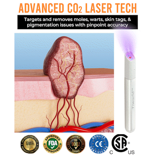 ✨TIWORLD™ All-in-One CO₂ Laser Eraser Pen | Removes Moles, Warts, Skin Flaws & Pigmentation