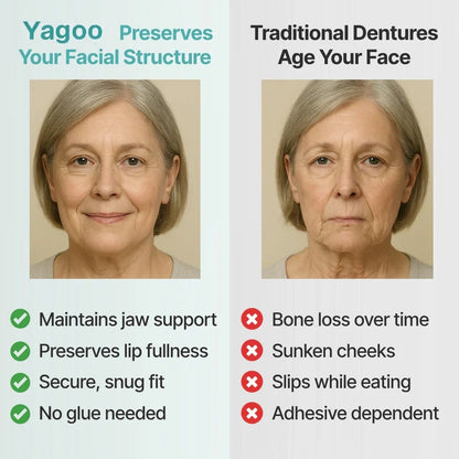 2026🏆🌎Ends Today: 70% OFF! ⏰Yagoo™ Medical Full Denture with Strong Suctiond🦷Obtain American Dental Association (ADA) Certification